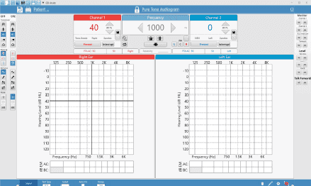 Acuity On-Screen Controls.png