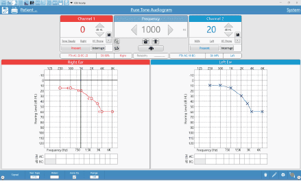 Acuity Synchronous Teleaudiology.png
