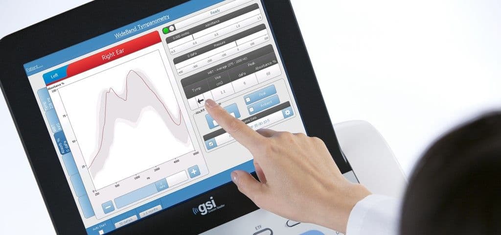 WideBand Tympanometry results on a TympStar Pro tympanometer screen