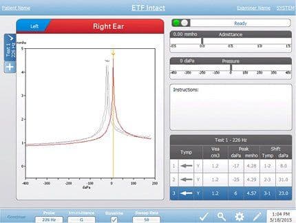 Eustachian tube function testing screen