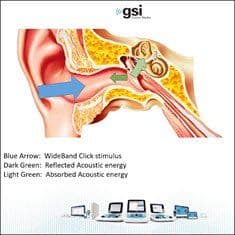 xwhats-the-hype-about-wideband-tympanometry.jpg