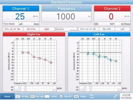 Sentiero Audiometer Interface Diagnostic Audiometer | Pello | Grason-Stadler